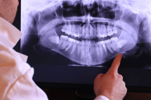Best Emergency Wisdom Teeth Removal in New Deal, TX